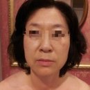 비비테라피 이미지