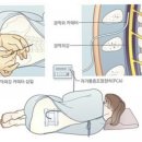 쪼식이