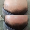 누네띠네헤어
