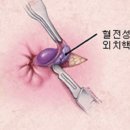 김묵환학문외과 네이버블로그
