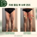 숲앤제이 에스테틱 | 신사동피부관리 숲앤제이 에스테틱 위치.가격.시간.후기