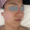 바디플러스샵 | 대구 남구 피부관리샵 [라플러스에스떼] 웨딩 관리 후기 / 작은 얼굴 웨딩 윤곽 케어 / 리프팅관리