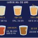 오줌 소변 색깔로 보는 건강 상태 단백뇨 이미지