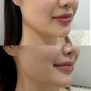 봉산로 | 대전 송강동｜터치미, 대전 에스테틱 피부 인퓨즈 리프팅 케어 후기