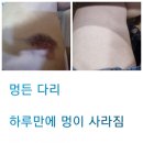 하루멍 이미지