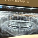 잘가요사랑니치과의원 이미지