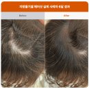 강남셀바이오뱅크 | Hair날 수 밖에 없는 지방줄기셀 헤어샷, 365mc 강남본점 단독 런칭!