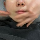상동에스테틱 솔에스테틱 경기부천점 Sol 베이직 앰플케어 후기