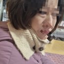 하라라성형외과의원 | 신사역 리아이 성형외과 원장님 상담 쌍수 눈밑지방재배치 강남재봉틀