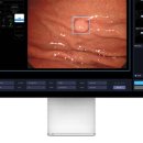 엔도헬스케어 이미지