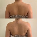 라피엘 | 인천 송도 신부관리 웨딩관리 잘하는 곳 라피엘 에스테틱 승모근 팔뚝 관리 강추