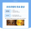 큰빛안과의원 이미지