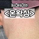 토탈미인만들기 | 성수왁싱 추천, ‘온왁싱’에서 뒷목 왁싱으로 매끈한 목선 만들기! (feat. 뒷목 전후 차이)