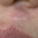 서울화봄의원 이미지