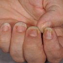 오닉스네일 이미지