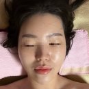 화스킨케어 | 부천 피부사랑바디체형관리에서 스톤 스킨케어 받고 온 후기