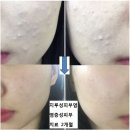 나헌식한의원 | 유아 아토피 이제4살된 딸입니다 치료 방법 없을까요 아이가 고통스러워 하는걸 보니 너무 안스럽습니다...