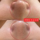 퓨어에스테틱 이미지