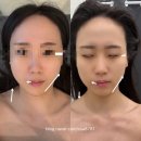 김소율샵 | 해운대 피부관리 에스테티아 마린시티점 윤곽관리 예신 관리 받고 온 후기