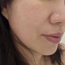 안양시자원회수시설_동 | 안양피부관리｜평촌피부관리 에스떼제이 윤곽관리 만족후기