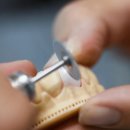 미래치과기공소 이미지