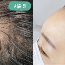 리헤어라인 - 논산시 | 리헤어라인