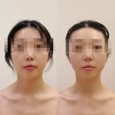리 에스테틱 - 서초구 | [광주/서구] 광주에스테틱 추천 화정동 리큐브에스테틱 윤곽관리후기
