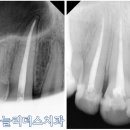 하늘치과기공소 이미지