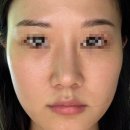 리즈펠리스 | 대전 리즈스킨 트라이엄 시술 후기 모공관리 탄력관리 탄방동 에스테틱 색소관리 내돈내산