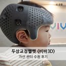 수정 | 사두 두상 교정 :: 비바 3D 헬멧 수정후기(+추천인 할인)