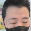 메릭스 | 안양 호계동 생기가득 한방병원 - 부부의 보톡스 시술 생생후기