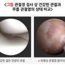 올바로 이미지
