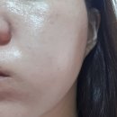 에끌로에스테틱 | 문정 피부 관리 에끌로 에스테틱 송파점 미백 관리 후기
