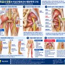 좌골신경통과 이상근증후군 마사지｜엉덩이 통증과 다리 저림은 어디서 시작될까요? 이미지