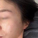 세븐일레븐대전괴정타운점 | 좁쌀여드름 관리 잘하는 대전 미모다뷰티 괴정점 방문 후기