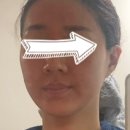 밝은달한의원 이미지