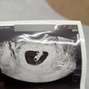 마린산부인과의원 | [임신 일기 #5] 강남 논현 근처 산부인과 추천 서브 병원 마린 산부인과의원