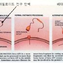 치매란 무엇일까요? 이미지