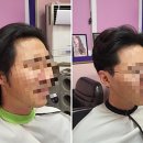 브로스컷 이미지