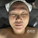 혜스테틱