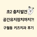초2 충치 치료 후기｜공간유지장치까지 한 인천 구월동 키즈웰치과 방문기