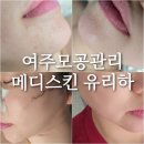 세종여주병원 - 3181 | 여주에스테틱 메디스킨 유리하 모공관리 후기