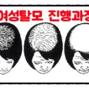 올맨 이미지