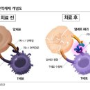 에스티큐브 면역관문억제제, 차세대 항암제로 기대- KB 이미지