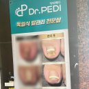 매료네일 문제성전문점 이미지