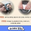 다래끼 나는 이유 빨리 낫는법 전염 원인 알아봐요 이미지