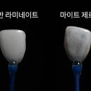 수석치과기공소 네이버블로그