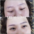 강남 아이라인 반영구 눈꼬리 처져 보이는 이유, 왜 라인을 했는데 오히려 피곤한 인상이 될까