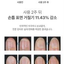 포인드 얇은 손톱에는 비건손톱영양제가 최고!!실사용 후기_2(네일영양제, 손톱강화제, 네일재료추천) 💅💅