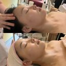 더나음에스테틱 | [이은주에스테틱][강남]강남역 윤곽관리 효과 찐강추 후기